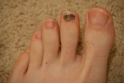 Χρήση από του στόματος και τοπικών φαρμάκων